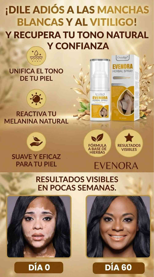 Oveallgo® Evenora Herbal Spray - ELIMINA EL VITILIGO Y RECUPERA TU SEGURIDAD..